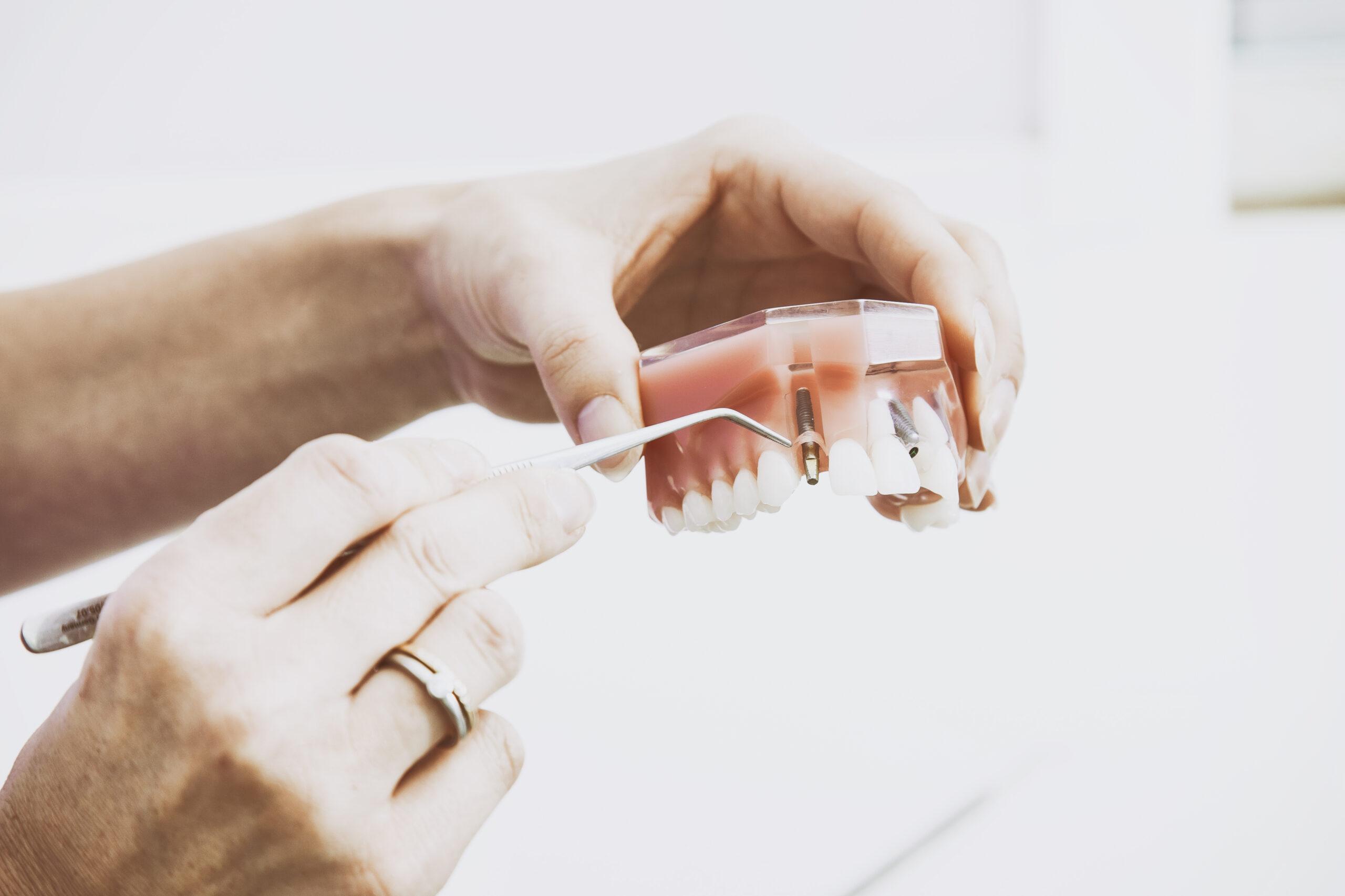 Tam ağız implant rehabilitasyonu planlamasında dental model